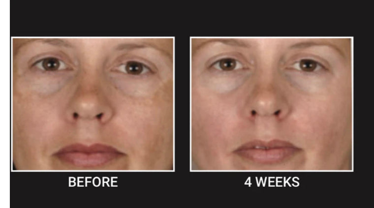 Buy Online Premium Quality ARA Vitamin C Cream Oil Moisturizer | Shop for the Best Anti-aging Skincare Products - Ara by Ageless